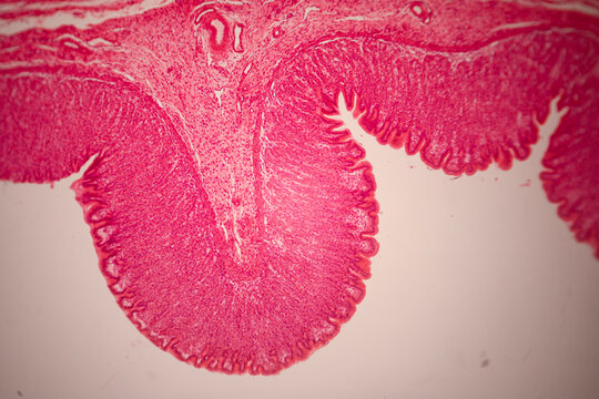 Microscopic stained section of tissue showing dense pink layered structures, pale cavities, and cellular textures.