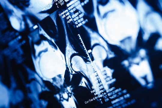 MRI scans show detailed views of knee joints in a medical setting during an examination process in a hospital