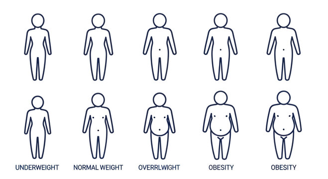 Body Mass Index Icons: Underweight to Obesity Categories