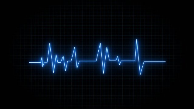 Glowing blue electrocardiogram waveform on dark grid background, neon heartbeat line across center
