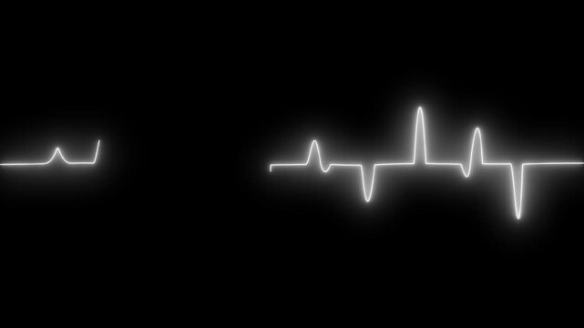 Glowing Electrocardiogram Line Animated, Digital Heart Monitor Wave in Neon Glow