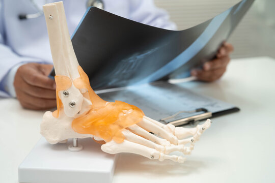 Doctor examining foot ankle  joint bone radiography xray film.