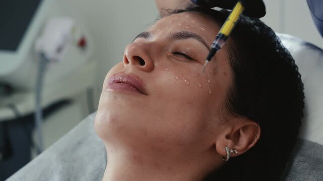 Close up of cosmetologist applying facial peeling treatment on young woman face using syringe. Professional skincare procedure in beauty clinic. Biorevitalization concept, skin rejuvenation, hydration