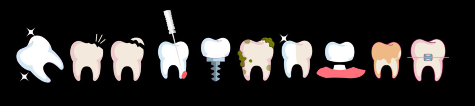 Tipos de Dentes