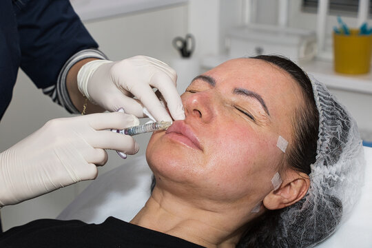 A cosmetologist performs lip augmentation injections on a middle-aged woman.