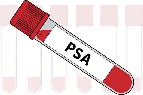 PSA blood test vial isolated on white background