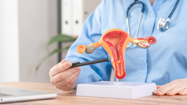 Medical professional in blue scrubs holds a detailed human reproductive anatomy model. Red and orange organ segments show ovaries and uterus. Stethoscope rests on their neck