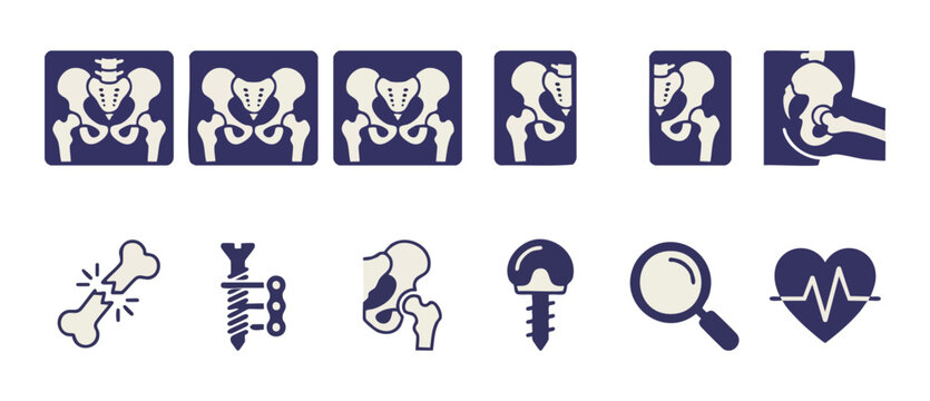 Pelvis X-ray Hip Replacement Orthopedic Icons Set Illustrating Bone Fracture, Surgical Plates, Medical Implants, and Healthcare Diagnostics for Clinical Reports and Orthopedic Surgeon Presentation Des