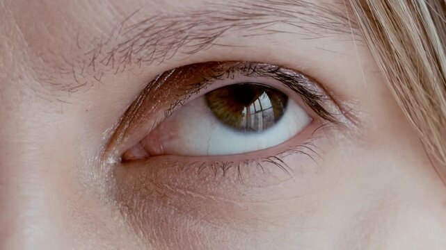 Close-up of a woman's eye, itching problem, infection, and observation of a doctor.