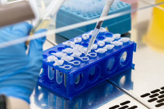 Conducting laboratory research and tests in the clinic laboratory, introducing liquid into the Eppendorf in a stand using a dispenser.