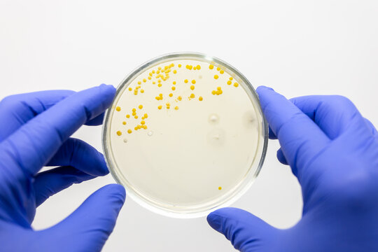 Yellow colonies of Staphylococcus aureus on nutrient agar in a petri dish, scientist holding an open petri dish with both hands.