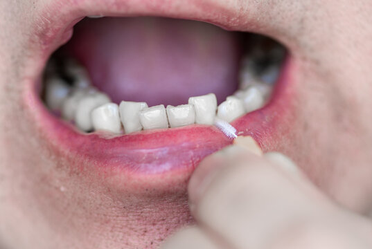 A close up of a person using a interdental brush to clean in between the teeth.