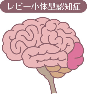 Lewy body dementia brain illustration line