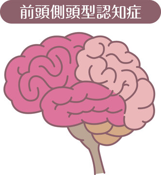 Frontotemporal dementia brain illustration line