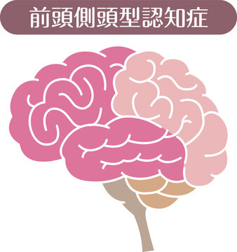 Frontotemporal dementia brain illustration flat