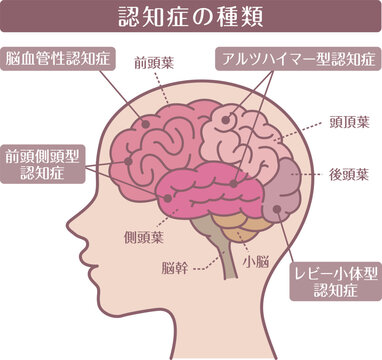 Dementia types brain diagram side view line