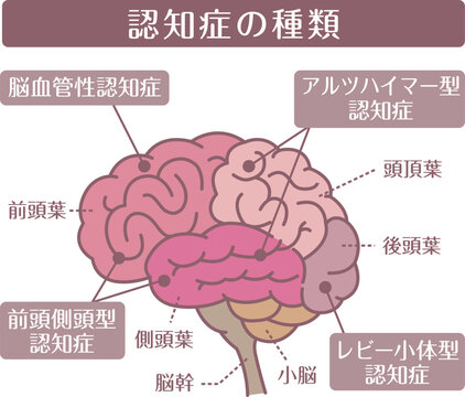 Types of dementia brain illustration line style
