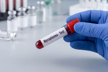 Naklejka premium Laboratory technician holds a blood sample for a mycoplasma bacterial infection test