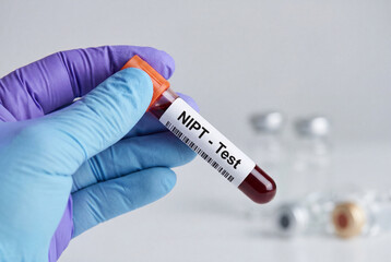 Obraz premium Doctor holds a blood sample for a NIPT non invasive prenatal screening test