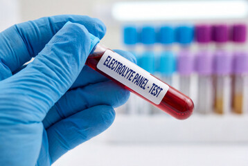 Obraz premium Lab technician holding electrolyte panel blood test tube in clinic