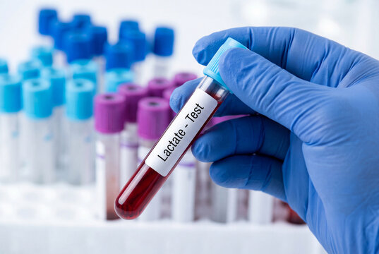 Lab professional holding lactate blood test tube in medical center