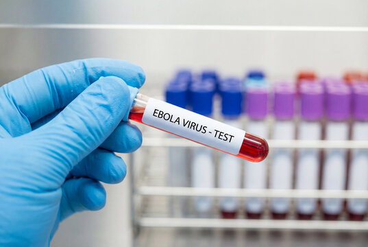 Medical expert holding ebola virus blood test tube in secure lab