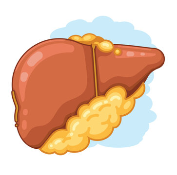 Fatty Liver