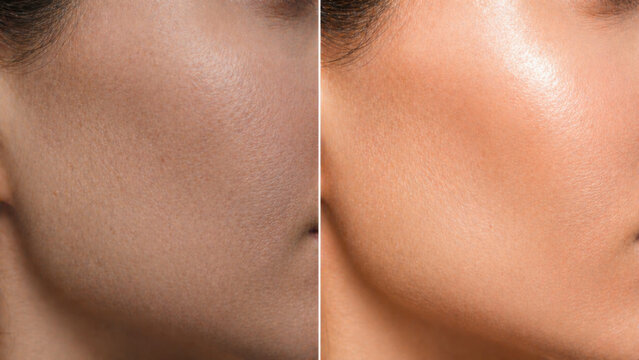 Revitalize skin with astaxanthin for radiant glow and improved texture, showcasing remarkable transformation in appearance