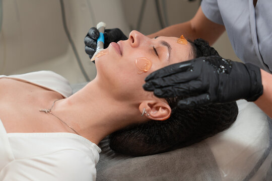 Close up of cosmetologist applying special facial gel on young woman before peeling procedure in beauty clinic. Skin preparation for professional cosmetology treatment. Skincare and aesthetic concept.