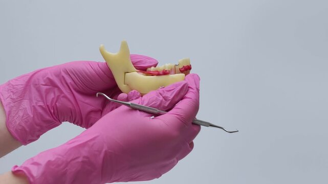 Dentist in Pink Gloves Explaining Tooth Anatomy on Jaw Model with Dental Probe