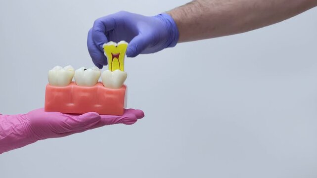 Removable Decayed Tooth Anatomy Model Demonstration