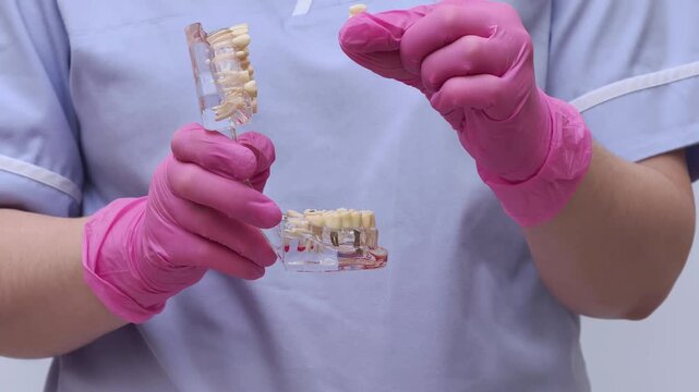 Dental Implant Bridge Models Demonstrated in Gloves