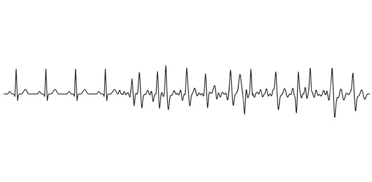 An image showing a rhythm disorder. Vector image. White background. It was created with artificial intelligence.