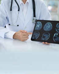 Naklejka premium Neurologist Doctor about cerebrovascular disease, migraine, Parkinson's disease, dementia and stroke at Neurology Center.