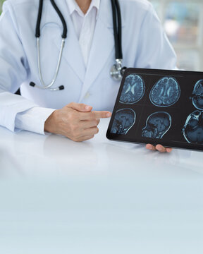 Neurologist Doctor about cerebrovascular disease, migraine, Parkinson's disease, dementia and stroke at Neurology Center.
