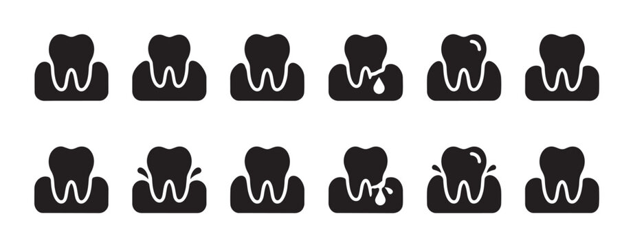 Collection of simple black icons illustrating different stages of gum disease affecting a tooth and its surrounding gums, ideal for medical and health infographics.