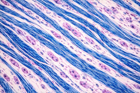 Histological image displaying longitudinal nerve fibers fixed and stained to reveal myelin sheaths