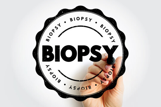 BIOPSY stamp with hand using marker to form circular emblem showing repeated word BIOPSY around strong central text. Medical themed badge expressing diagnostic concept in clear bold typographic style