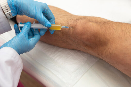 Doctor injects plasma into patient's knee. Joint plasma therapy. Patient's own biomaterial. Knee joint. Treatment of joint pain without surgery. Latest methods of joint treatment. Regeneration of