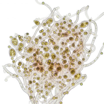 Microscopic view of fungal hyphae, spores, and conidia cluster isolated on a transparent background