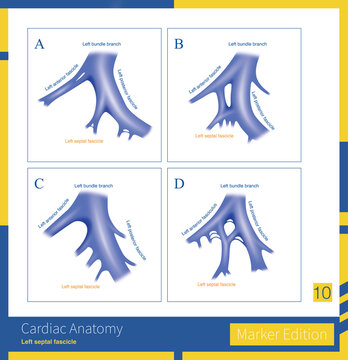The left bundle branch is mainly divided into the left anterior fasciculus and the left posterior fasciculus. Some of their branches further converge to form the left septal fasciculus.