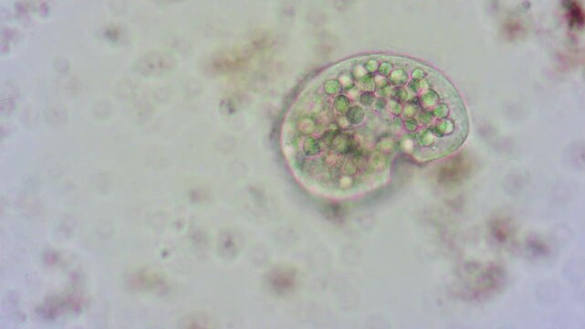 Movement of a protozoan microorganism in a liquid among bacteria, magnification of plankton and protozoa using a microscope.