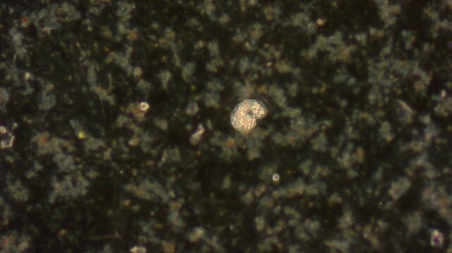 Living unicellular protozoa move among bacteria with the help of small cilia; inside the cell there are many inclusions and vesicles.