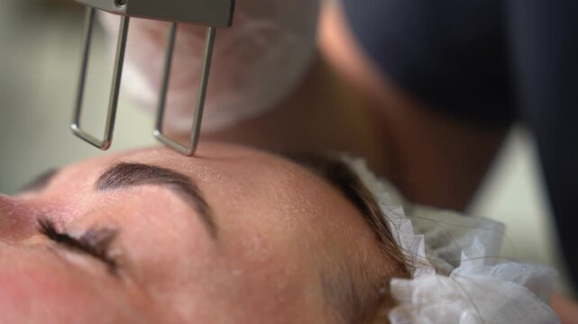 Close up of fractional CO2 laser skin rejuvenation on forehead for wrinkle reduction and professional resurfacing treatment in aesthetic medical clinic using advanced hardware technology for anti
