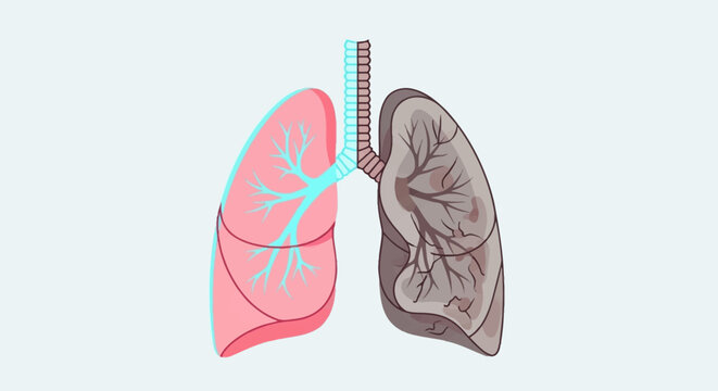 Illustration comparing a healthy pink lung with a diseased, dark grey lung, highlighting the effects of smoking or pollution on respiratory health.