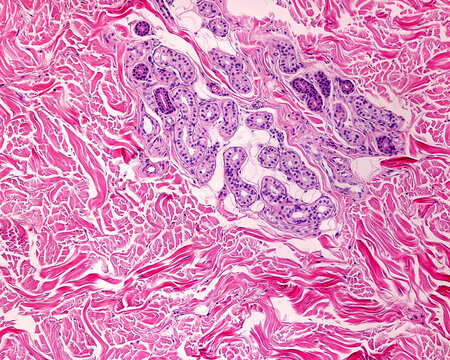 Human skin. Dermis. Sweat gland