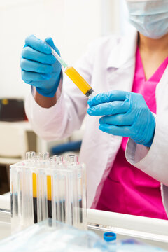 Blood plasma in tubes. Chemistry laboratory. Regenerative medicine. Non-surgical procedures. Lab technician holding test tube of blood sample after being centrifuged. Blood taken from patient
