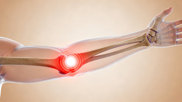 Human arm with elbow joint highlighted in red pain, showing bones and muscles, isolated on transparent background