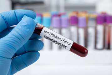 Naklejka premium Gloved hand holding von willebrand factor blood test tube