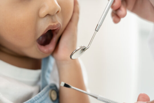 Dentist or dentist treating or examining a little girl teeth, Child receiving treatment from dentist, medicine, dentistry and healthcare, annual checkup, fluoride coating, tooth decay